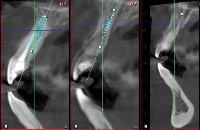 3D CT technology