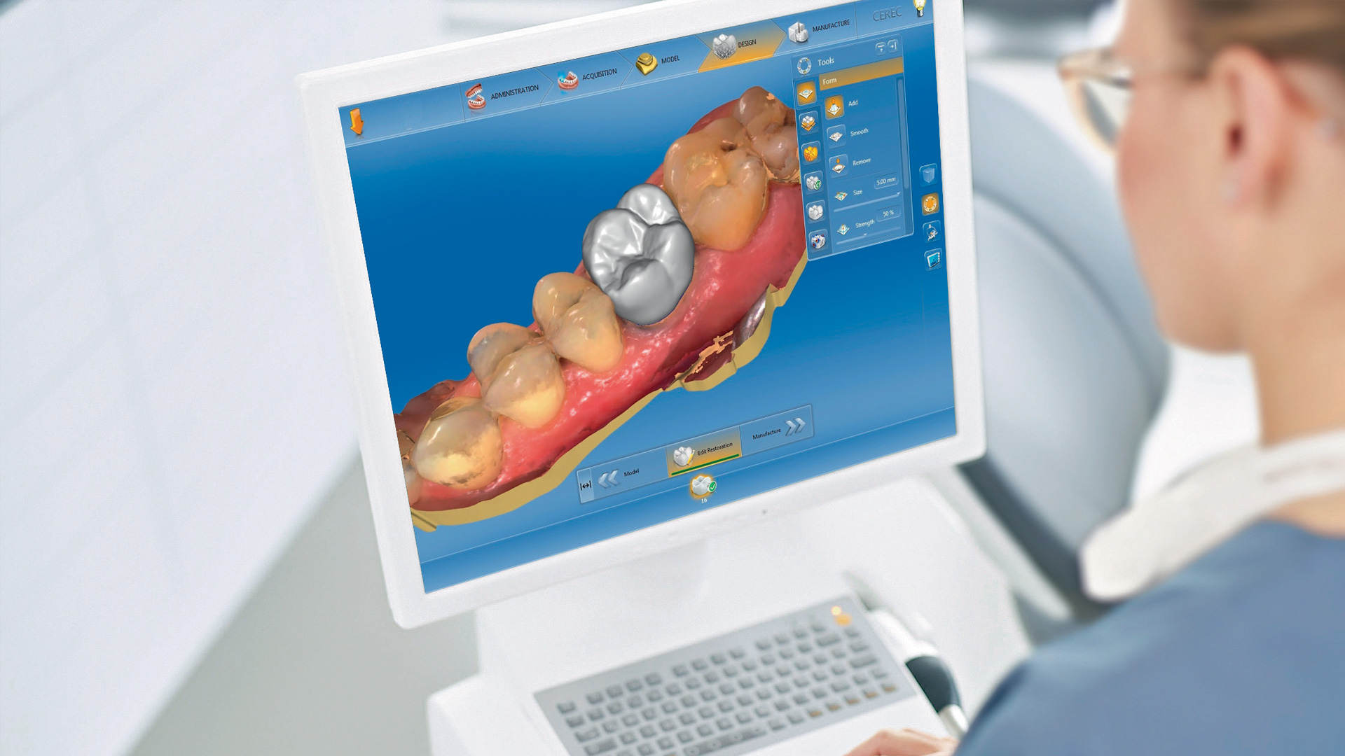 CEREC Same-Day Crowns