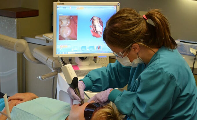 CEREC Scanning Teeth