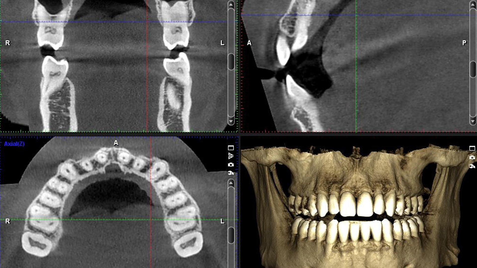 Ct Scan 3d Technology Mint Hill Dentistry Dentist Charlotte Nc