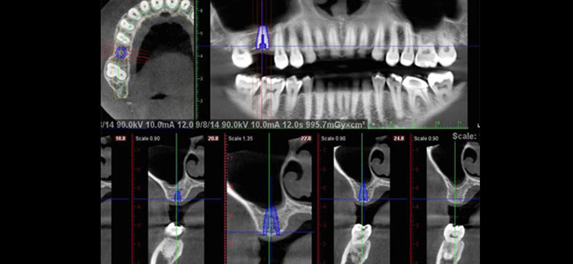 CT Scan Uses: Scenario One