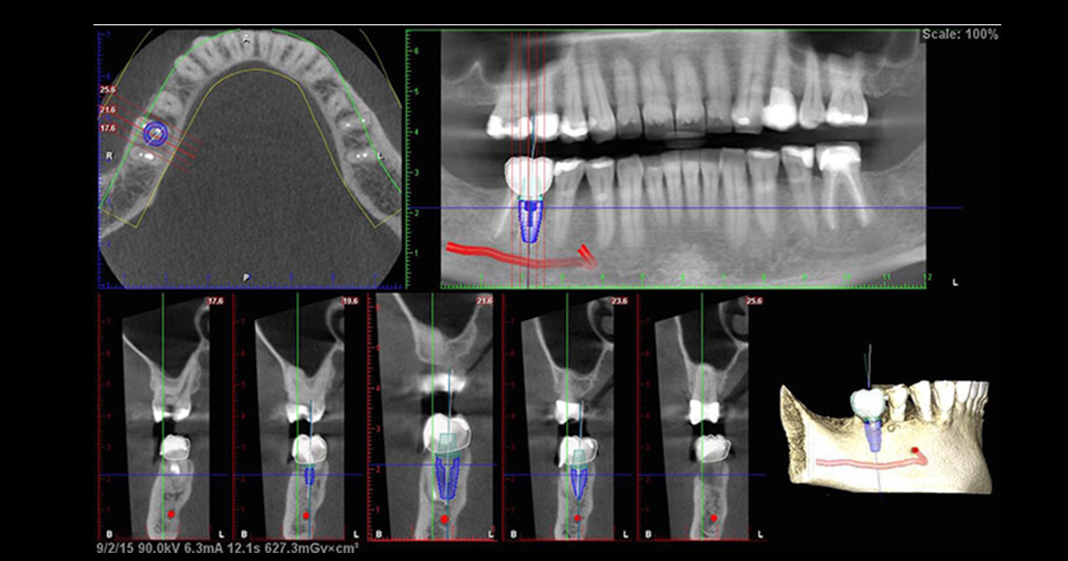 mint dentistry mint dentistry