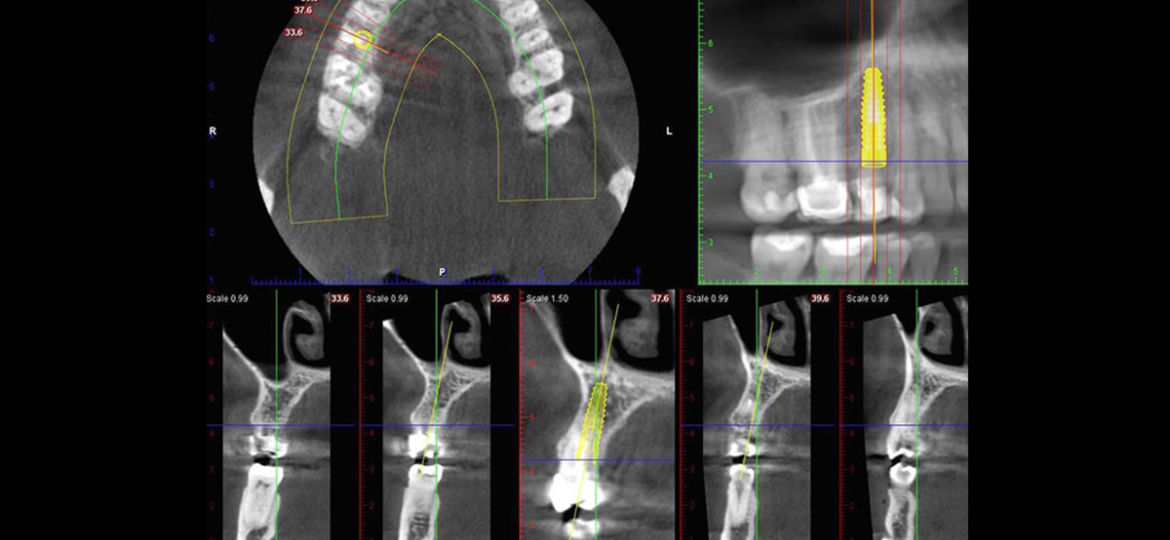 CT Scan Uses: Scenario Three