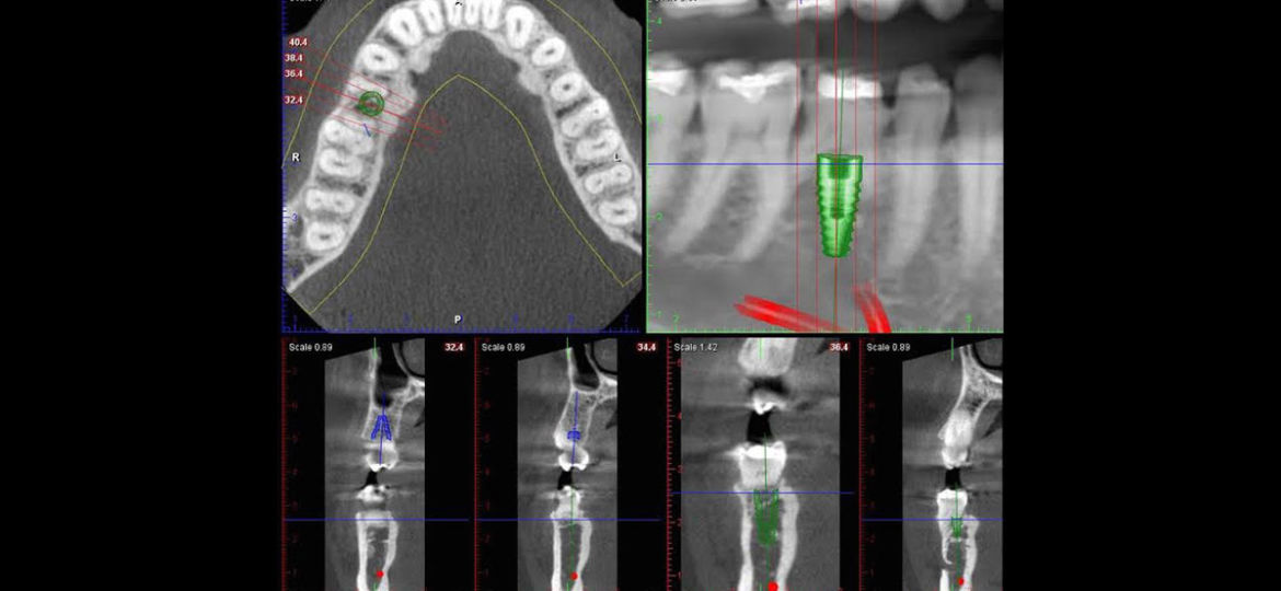 CT Scan Uses: Scenario Four