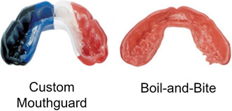 Custom sports mouth guards