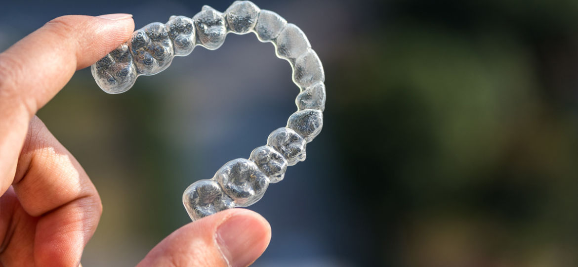 The Straight Facts About DIY Braces