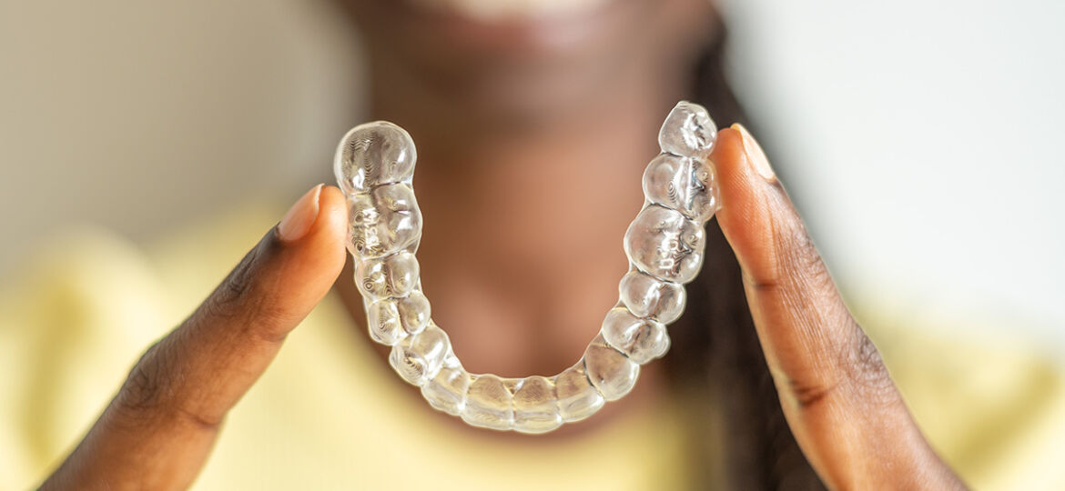 Guide to Invisalign