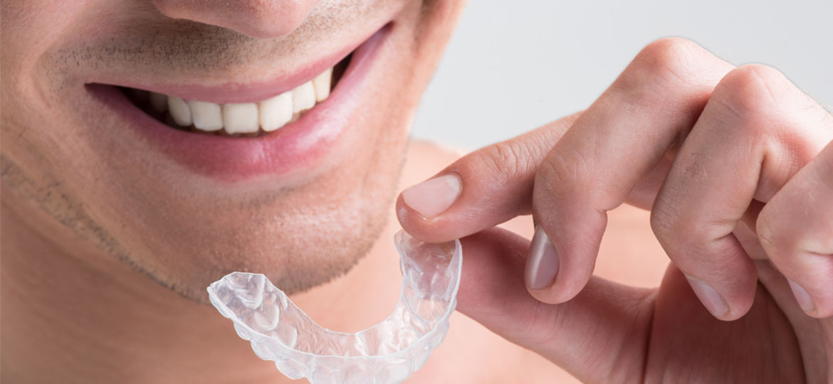 How Do I Know if I Am an Invisalign Candidate?