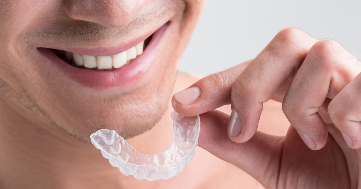 How Do I Know if I Am an Invisalign Candidate? Mint Hill Dentistry
