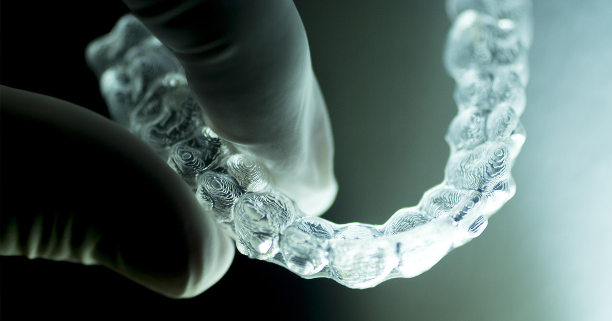 Invisalign’s New Technology Mint Hill Dentistry Dentist Charlotte NC