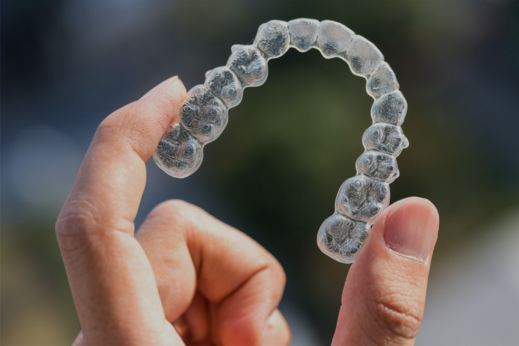 Invisalign Clear Aligners