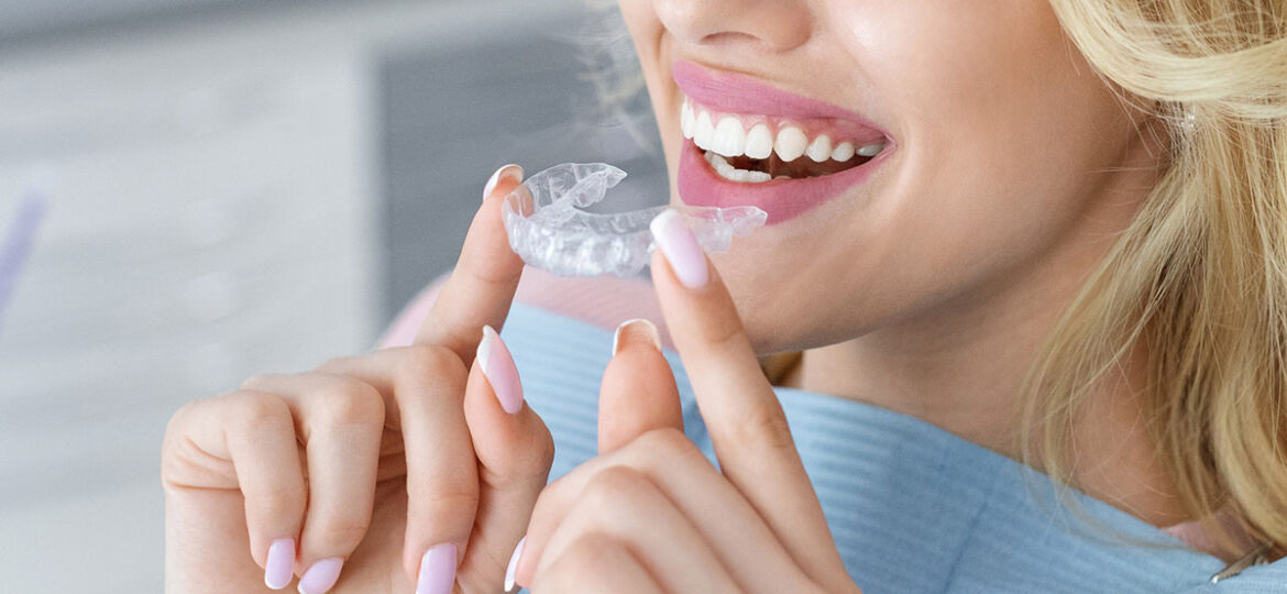 Invisalign Tray