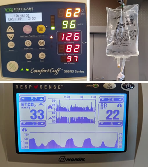 Sedation safety and dental monitoring