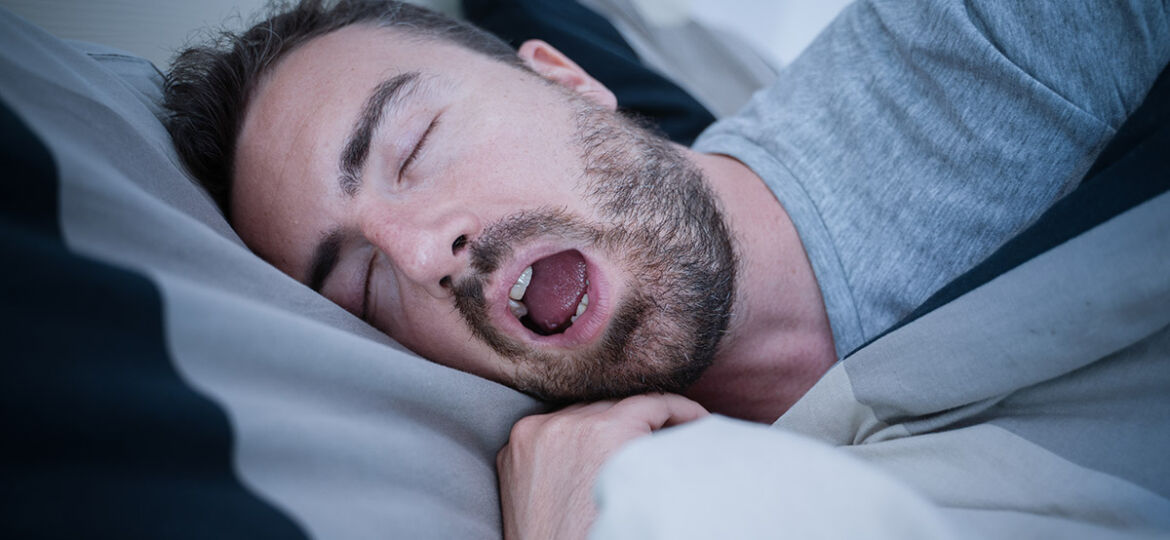 Sleep apnea oral appliances