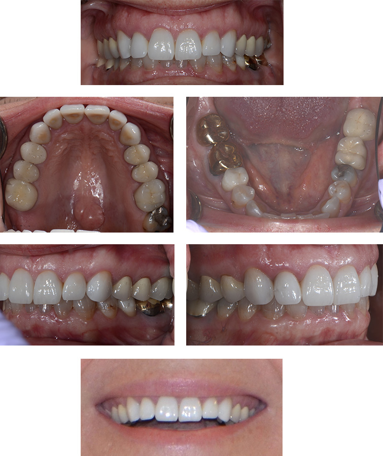 Digital Photography Mint Hill Dentistry Dentist Charlotte NC digital-photography-mint-hill-dentistry-dentist-charlotte-nc