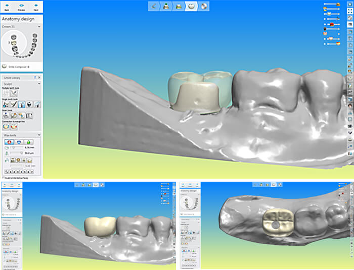 Step 3 - Digital Crown Design