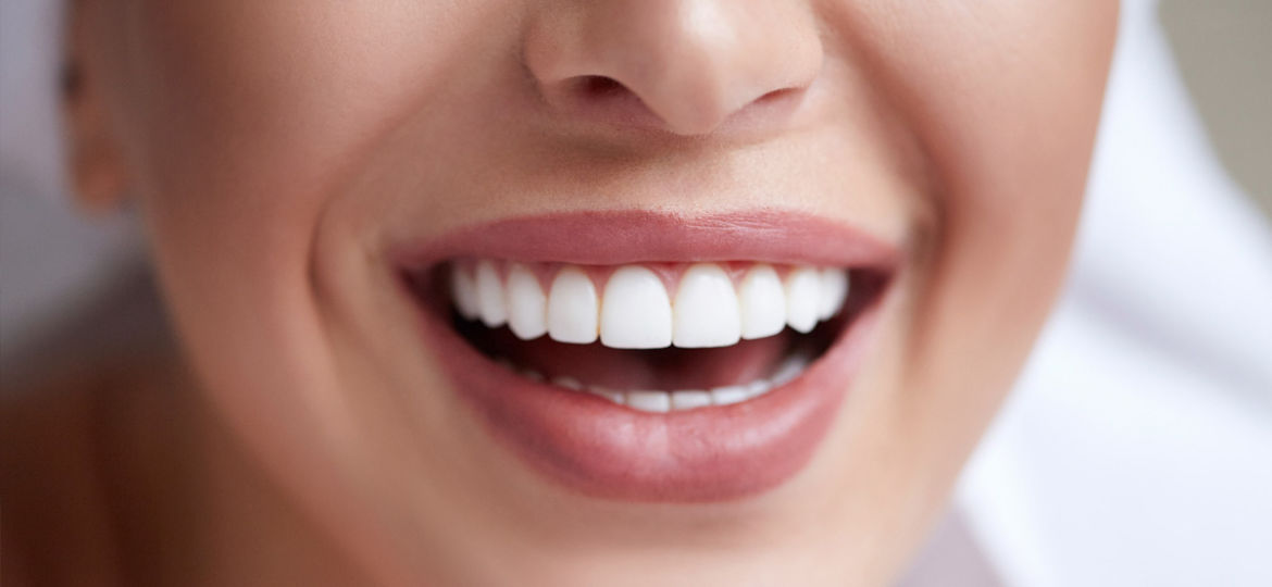 Veneers Can Make a Beautiful Smile