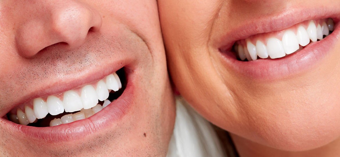 Will Tooth Whitening Work For Me?